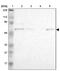 Zinc Finger Protein 550 antibody, PA5-51875, Invitrogen Antibodies, Western Blot image 