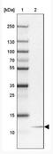 NOP10 Ribonucleoprotein antibody, NBP2-32441, Novus Biologicals, Western Blot image 