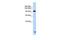 Trinucleotide Repeat Containing Adaptor 6B antibody, GTX47405, GeneTex, Western Blot image 