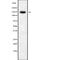 BMS1 Ribosome Biogenesis Factor antibody, abx148652, Abbexa, Western Blot image 