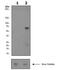 Spleen Associated Tyrosine Kinase antibody, ab62338, Abcam, Western Blot image 