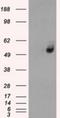 Solute Carrier Family 2 Member 6 antibody, NBP1-47987, Novus Biologicals, Western Blot image 