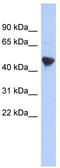 Immediate Early Response 5 Like antibody, TA333318, Origene, Western Blot image 