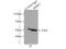 Matrix Metallopeptidase 1 antibody, 10371-2-AP, Proteintech Group, Immunoprecipitation image 