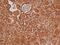 Presenilin-2 antibody, GTX11148, GeneTex, Immunohistochemistry paraffin image 