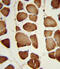 Nicotinamide Phosphoribosyltransferase antibody, abx034196, Abbexa, Immunohistochemistry paraffin image 