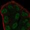 Zinc Finger MYM-Type Containing 6 antibody, NBP2-57924, Novus Biologicals, Immunofluorescence image 
