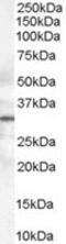 Syntaxin 6 antibody, MBS421504, MyBioSource, Western Blot image 