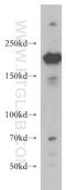 ERCC Excision Repair 5, Endonuclease antibody, 11331-1-AP, Proteintech Group, Western Blot image 