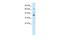 POU Class 4 Homeobox 3 antibody, PA5-40644, Invitrogen Antibodies, Western Blot image 