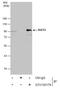 SUZ12 Polycomb Repressive Complex 2 Subunit antibody, GTX130179, GeneTex, Immunoprecipitation image 