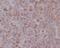 Interferon Regulatory Factor 7 antibody, M00115, Boster Biological Technology, Immunohistochemistry paraffin image 