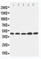 Hepsin antibody, PA2035, Boster Biological Technology, Western Blot image 