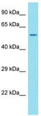 Ankyrin Repeat Domain 34C antibody, TA334900, Origene, Western Blot image 