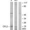 Cofilin 2 antibody, PA5-49917, Invitrogen Antibodies, Western Blot image 