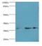 Glutathione S-Transferase Omega 2 antibody, LS-C379577, Lifespan Biosciences, Western Blot image 