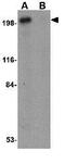 CD49D antibody, GTX31777, GeneTex, Western Blot image 