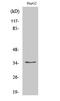 NK3 Homeobox 1 antibody, A02709-3, Boster Biological Technology, Western Blot image 