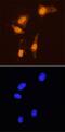 FOXP3 antibody, MAB8214, R&D Systems, Immunocytochemistry image 