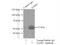 Death Associated Protein Kinase 3 antibody, 51021-1-AP, Proteintech Group, Immunoprecipitation image 