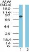 Smoothened, Frizzled Class Receptor antibody, PA1-41500, Invitrogen Antibodies, Western Blot image 