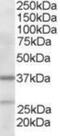 Actin Related Protein 2/3 Complex Subunit 1B antibody, NB300-898, Novus Biologicals, Western Blot image 