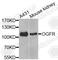 Opioid Growth Factor Receptor antibody, A7074, ABclonal Technology, Western Blot image 