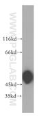 Actin Related Protein 3B antibody, 17022-1-AP, Proteintech Group, Western Blot image 