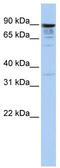 Multiple C2 And Transmembrane Domain Containing 1 antibody, TA335300, Origene, Western Blot image 