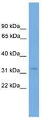 Transcription Elongation Factor A2 antibody, TA344425, Origene, Western Blot image 