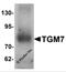 Transglutaminase 7 antibody, 6541, ProSci Inc, Western Blot image 