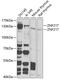 Zinc Finger Protein 217 antibody, 22-623, ProSci, Western Blot image 