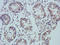 Midline 1 antibody, orb338841, Biorbyt, Immunohistochemistry paraffin image 