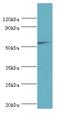 Interferon Gamma Receptor 1 antibody, MBS1492592, MyBioSource, Western Blot image 