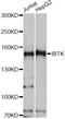 Inhibitor Of Bruton Tyrosine Kinase antibody, LS-C749847, Lifespan Biosciences, Western Blot image 