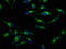 Solute Carrier Family 5 Member 8 antibody, LS-C673380, Lifespan Biosciences, Immunofluorescence image 