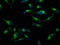 Sodium-coupled monocarboxylate transporter 1 antibody, LS-C673380, Lifespan Biosciences, Immunofluorescence image 