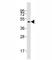 SMAD Family Member 3 antibody, F53247-0.4ML, NSJ Bioreagents, Western Blot image 
