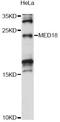 Mediator Complex Subunit 18 antibody, LS-C749587, Lifespan Biosciences, Western Blot image 