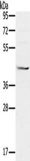 Mevalonate Kinase antibody, TA350193, Origene, Western Blot image 