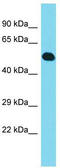 C-Type Lectin Domain Family 18 Member B antibody, TA336114, Origene, Western Blot image 