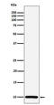 Cytochrome C Oxidase Subunit 6B1 antibody, M10285, Boster Biological Technology, Western Blot image 