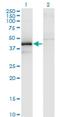 Zinc Finger FYVE-Type Containing 19 antibody, H00084936-M02, Novus Biologicals, Western Blot image 