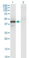 Zinc finger FYVE domain-containing protein 19 antibody, H00084936-M02, Novus Biologicals, Western Blot image 