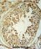 Copine 8 antibody, abx032481, Abbexa, Immunohistochemistry paraffin image 