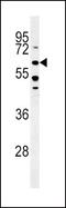 Bone Morphogenetic Protein Receptor Type 1A antibody, PA5-11857, Invitrogen Antibodies, Western Blot image 