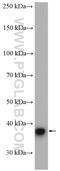 Potassium Voltage-Gated Channel Subfamily A Regulatory Beta Subunit 2 antibody, 17890-1-AP, Proteintech Group, Western Blot image 