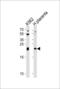Interleukin 31 antibody, LS-C165207, Lifespan Biosciences, Western Blot image 