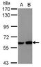 Myocyte Enhancer Factor 2D antibody, PA5-30950, Invitrogen Antibodies, Western Blot image 