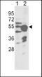 Cytochrome P450 Family 2 Subfamily R Member 1 antibody, 63-274, ProSci, Western Blot image 